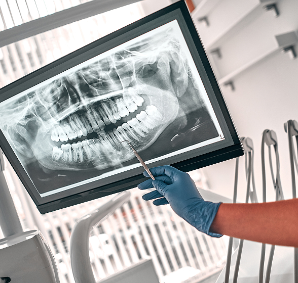 dental x-rays
