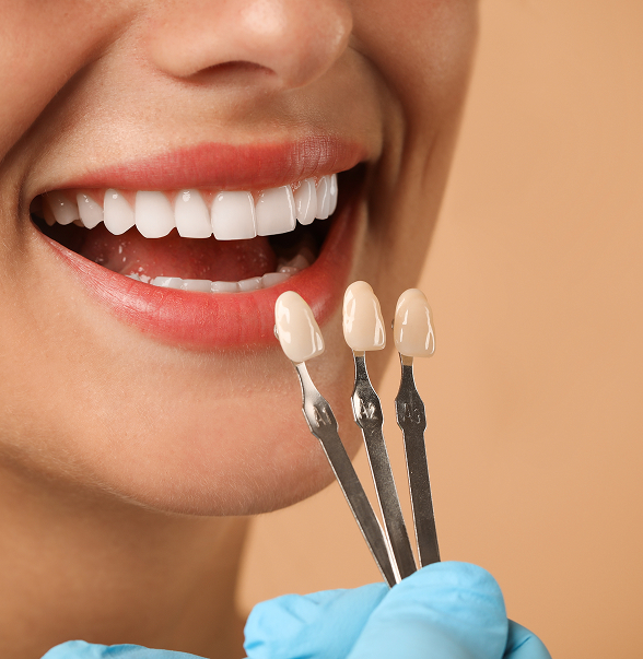 porcelain veneers near you