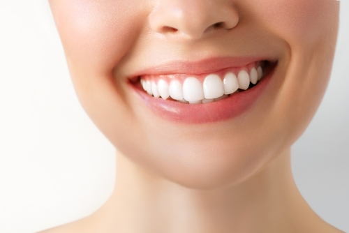 perfect smile