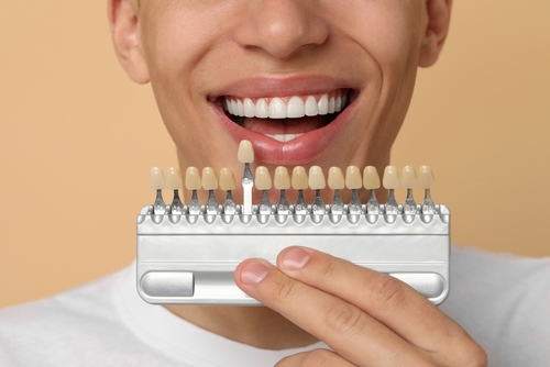 porcelain veneers in St Clair Shores